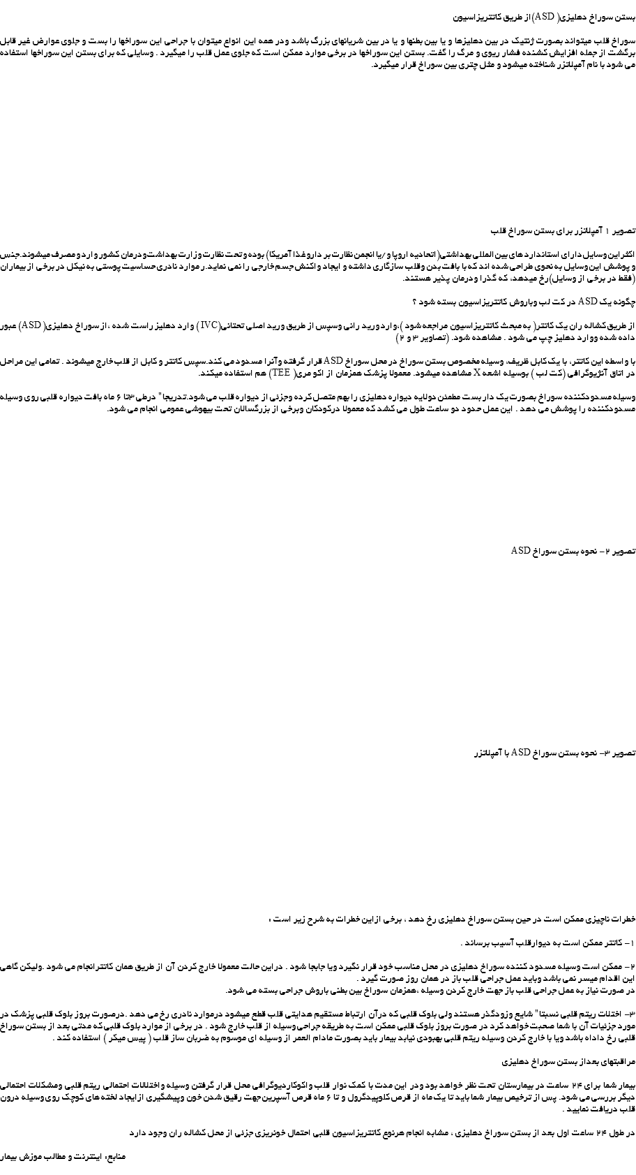  بستن سوراخ دهلیزی( ASD)از طریق کاتتریزاسیون سوراخ قلب میتواند بصورت ژنتیک در بین دهلیزها و یا بین بطنها و یا در بین شریانهای بزرگ باشد ودر همه این انواع میتوان با جراحی این سوراخها را بست و جلوی عوارض غیر قابل برگشت از جمله افزایش کشنده فشار ریوی و مرگ را گفت. بستن این سوراخها در برخی موارد ممکن است که جلوی عمل قلب را میگیرد . وسایلی که برای بستن این سوراخها استفاده می شود با نام آمپلاتزر شناخته میشود و مثل چتری بین سوراخ قرار میگیرد. تصویر 1 آمپلاتزر برای بستن سوراخ قلب اکثراین وسایل دارای استاندارد های بین المللی بهداشتی(اتحادیه اروپا و/یا انجمن نظارت بر دارو غذا آمریکا) بوده و تحت نظارت وزارت بهداشت ودرمان کشور وارد و مصرف میشوند.جنس و پوشش این وسایل به نحوی طراحی شده اند که با بافت بدن وقلب سازگاری داشته و ایجاد واکنش جسم خارجی را نمی نماید.ر موارد نادری حساسیت پوستی به نیکل در برخی از بیماران(فقط در برخی از وسایل)رخ میدهد، که گذرا ودرمان پذیر هستند. چگونه یک ASD در کت لب وباروش کاتتریزاسیون بسته شود ؟ از طریق کشاله ران یک کاتتر( به مبحث کاتتریزاسیون مراجعه شود )،وارد ورید رانی وسپس از طریق ورید اصلی تحتانی(IVC ) وارد دهلیز راست شده ،از سوراخ دهلیزی( ASD) عبور داده شده ووارد دهلیز چپ می شود . مشاهده شود. (تصاویر 3 و 2) با واسطه این کاتتر، با یک کابل ظریف، وسیله مخصوص بستن سوراخ در محل سوراخ ASD قرار گرفته وآنرا مسدود می کند.سپس کاتتر و کابل از قلب خارج میشوند . تمامی این مراحل در اتاق آنژیوگرافی (کت لب ) بوسیله اشعه X مشاهده میشود. معمولا پزشک همزمان از اکو مری( TEE) هم استفاده میکند. وسیله مسدودکننده سوراخ بصورت یک دار بست مطمئن دولایه دیواره دهلیزی را بهم متصل کرده وجزئی از دیواره قلب می شود.تدریجا" درطی 3تا 6 ماه بافت دیواره قلبی روی وسیله مسدودکننده را پوشش می دهد . این عمل حدود دو ساعت طول می کشد که معمولا درکودکان وبرخی از بزرگسالان تحت بیهوشی عمومی انجام می شود. تصویر 2- نحوه بستن سوراخ ASD تصویر 3- نحوه بستن سوراخ ASD با آمپلاتزر خطرات ناچیزی ممکن است در حین بستن سوراخ دهلیزی رخ دهد ، برخی ازاین خطرات به شرح زیر است : 1- کاتتر ممکن است به دیوارقلب آسیب برساند . 2- ممکن است وسیله مسدود کننده سوراخ دهلیزی در محل مناسب خود قرار نگیرد ویا جابجا شود . دراین حالت معمولا خارج کردن آن از طریق همان کاتترانجام می شود .ولیکن گاهی این اقدام میسر نمی باشد وباید عمل جراحی قلب باز در همان روز صورت گیرد . در صورت نیاز به عمل جراحی قلب باز جهت خارج کردن وسیله ،همزمان سوراخ بین بطنی باروش جراحی بسته می شود. 3- اختلات ریتم قلبی نسبتا" شایع وزودگذر هستند ولی بلوک قلبی که درآن ارتباط مستقیم هدایتی قلب قطع میشود درموارد نادری رخ می دهد .درصورت بروز بلوک قلبی پزشک در مورد جزئیات آن با شما صحبت خواهد کرد در صورت بروز بلوک قلبی ممکن است به طریقه جراحی وسیله از قلب خارج شود . در برخی از موارد بلوک قلبی که مدتی بعد از بستن سوراخ قلبی رخ داداه باشد ویا با خارج کردن وسیله ریتم قلبی بهبودی نیابد بیمار باید بصورت مادام العمر از وسیله ای موسوم به ضربان ساز قلب ( پیس میکر ) استفاده کند . مراقبتهای بعداز بستن سوراخ دهلیزی بیمار شما برای 24 ساعت در بیمارستان تحت نظر خواهد بود ودر این مدت با کمک نوار قلب واکوکاردیوگرافی محل قرار گرفتن وسیله واختلالات احتمالی ریتم قلبی ومشکلات احتمالی دیگر بررسی می شود. پس از ترخیص بیمار شما باید تا یک ماه از قرص کلوپیدگرول و تا 6 ماه قرص آسپرین جهت رقیق شدن خون وپیشگیری ازایجاد لخته های کوچک روی وسیله درون قلب دریافت نمایید . در طول 24 ساعت اول بعد از بستن سوراخ دهلیزی ، مشابه انجام هرنوع کاتتریزاسیون قلبی احتمال خونریزی جزئی از محل کشاله ران وجود دارد منابع: اینترنت و مطالب موزش بیمار 