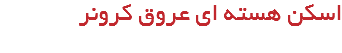 اسکن هسته ای عروق کرونر