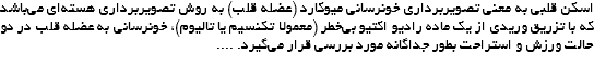 اسکن قلبی به معنی تصویربرداری خونرسانی میوکارد (عضله قلب) به روش تصویربرداری هسته‌ای می‌باشد که با تزریق وریدی از یک ماده رادیو اکتیو بی‌خطر (معمولا تکنسیم یا تالیوم)، خونرسانی به عضله قلب در دو حالت ورزش و استراحت بطور جداگانه مورد بررسی قرار می‌‌‌گیرد. .... 