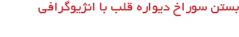 بستن سوراخ دیواره قلب با انژیوگرافی 
